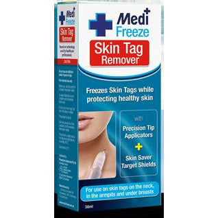 Medi Freeze Skin Tag Remover, 38 ml